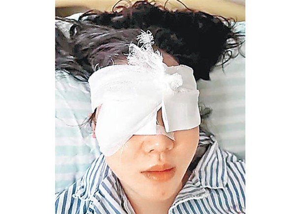 雲南遊客玩高壓水槍  婦遭射中右眼重傷