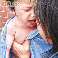 女嬰嚴重燙傷，送院時嚎哭不止。	（本報彰化傳真）