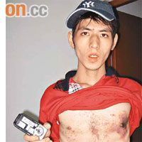 ○七年六月，廣州白雲區蔡亞弟的手機突然爆炸，其胸膛被炸傷。	（資料圖片）