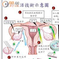 體外激活技術示意圖