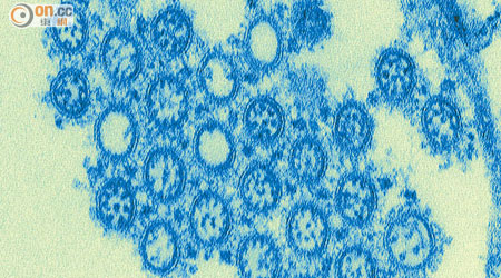 美加近日爆發的H1N1甲型流感，病毒與○九年的相若。
