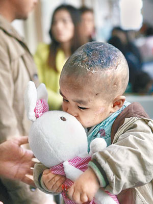 燙傷的小寶在玩弄熱心市民贈送的玩具。（互聯網圖片）