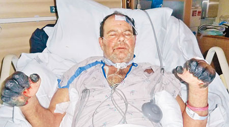 蓋洛德在醫院昏迷近一個月後奇迹甦醒。（互聯網圖片）