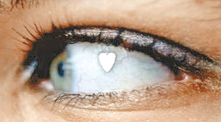 科亞列夫斯基亞的右眼眼白（鏡中反射）植入心形白金片。（互聯網圖片）