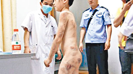 彬彬全身傷痕，被警員送院診治。（互聯網圖片）