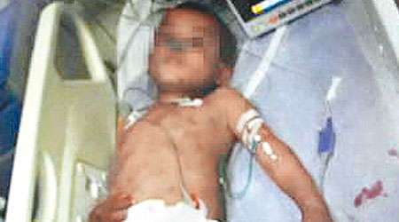 受虐男童小豪被送醫院搶救。（互聯網圖片）