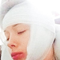 盧基揚諾娃頭顎及嘴唇受傷，綁上繃帶。（互聯網圖片）