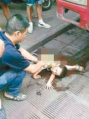 雲南<br>男童遭貨車輾碎下半身。（互聯網圖片）