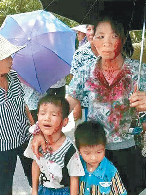 有小童及婦人在衝突中受傷。（互聯網圖片）