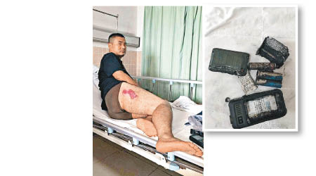 曹先生褲袋內的手機爆炸（圖）令大腿受傷。（互聯網圖片）