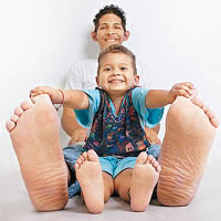 大腳板：委內瑞拉20歲男子埃爾南德斯擁有最大腳掌，右腳腳掌長40.1厘米，左腳腳掌則長39.6厘米。