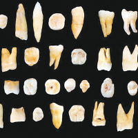 專家分析牙齒化石，發現與現代人牙齒非常相似。