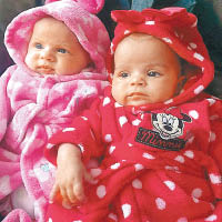雙胞胎女嬰一黑一白，相映成趣。（互聯網圖片）