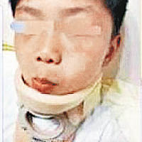 幼兒園學童事後受傷要戴頸箍。（互聯網圖片）