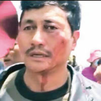 有藏民被打傷流血。（互聯網圖片）