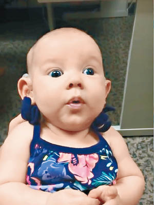 女嬰戴上助聽器後首次聽到母親的聲音。（互聯網圖片）
