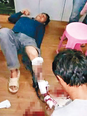 腿部受傷男子接受包紮。