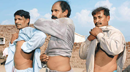 巴基斯坦窮人排隊售賣腎臟。
