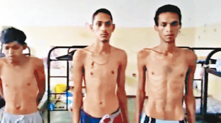 委內瑞拉監獄不少囚犯身體骨瘦如柴。