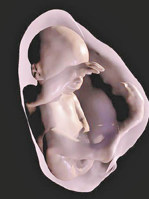 新技術清晰呈現胎兒的模樣。（Radiological Society of North America圖片）