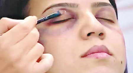 化妝師在節目中示範如何以化妝品遮掩傷痕。（電視畫面）
