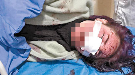 麗江遇襲的女子送院時昏迷。（資料圖片）
