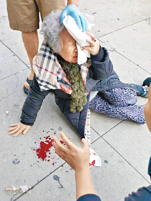 韓裔老婆婆被打至頭破血流。