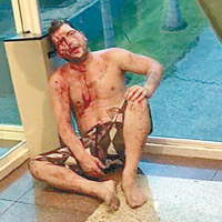 一名男子在混亂中受傷，血流披面。