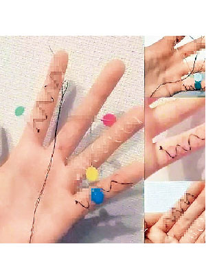 網傳「人體刺繡」的照片，有體驗者將針線縫在手指上。（互聯網圖片）