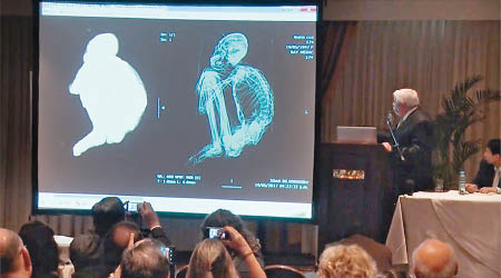 毛森在記者會上展示「外星人」X光片。（互聯網圖片）