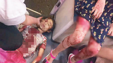有女童被斬至重傷。（互聯網圖片）