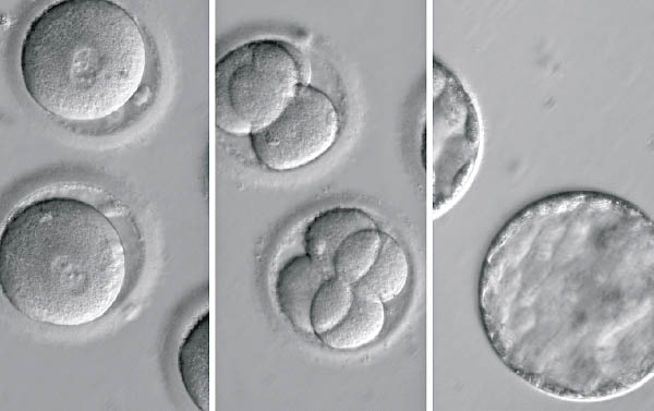 修復胚胎基因　根絕遺傳病 0804-00180-033b1