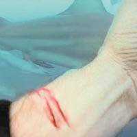 托馬斯的手腕冒出鮮血。（互聯網圖片）