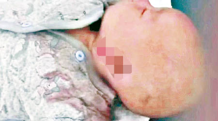 男嬰慘遭生母割下耳朵。（互聯網圖片）