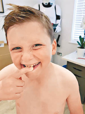 薩姆開始改善刷牙習慣。（互聯網圖片）