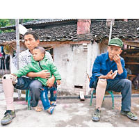 麻栗坡縣一對父子同被地雷炸傷，失去右腿。