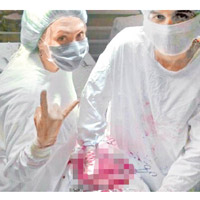下塔吉爾有醫護人員在施手術時，舉起手勢拍照。（互聯網圖片）