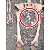 孕婦骸骨的股間有幾塊小骨頭（紅圈示）。