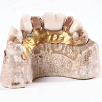 英國國王威廉四世的假牙。