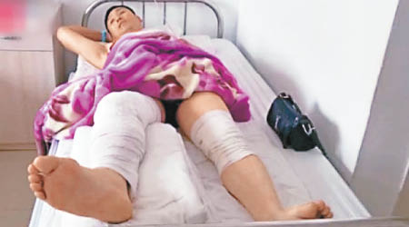 王男右腳受傷，但醫生竟在其左腳開刀。（互聯網圖片）