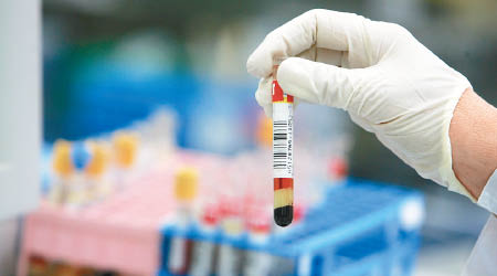 有指新的血液測試法可在患者未病發前已能測出癌症。