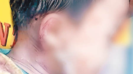 男童被村內惡犬咬下頭皮。（互聯網圖片）
