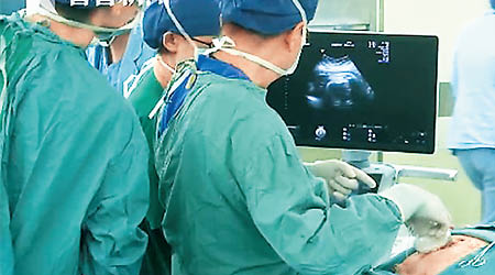 醫生為周女肚內的胎兒做手術。（互聯網圖片）