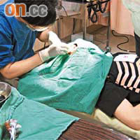 蕭敬騰拍MV狂奔撞爆右眉骨，縫了五針。