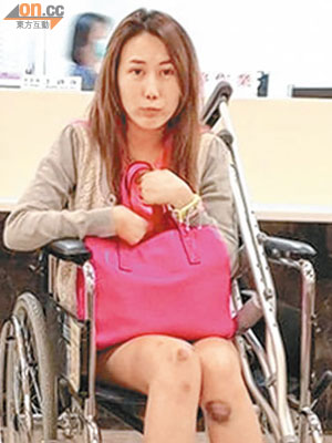 Naomi發生意外，左右腳有多處瘀傷，連頸及胸口都受傷。
