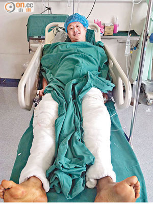 手術後的吳京雙腿都包滿繃帶。