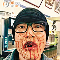 盧惠光於戲中被打至血流披面。