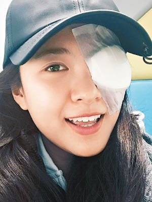 江嘉敏因手術後眼睛腫了，要休息數天。