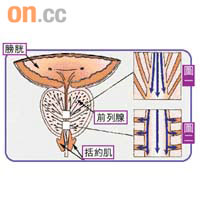 位於前列腺下方的括約肌，原負責控制失禁（圖一所示），若該組肌肉無法放鬆，膀胱壓力會將尿液擠壓入前列腺，引起發炎（圖二所示）。