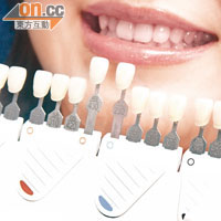 牙齒美白療程一般可以有5至7個色階的美白效果。